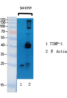 TIMP-1 Polyclonal Antibody