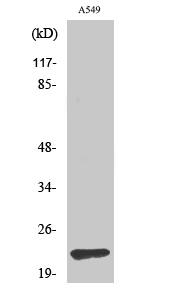 TIMP-2 Polyclonal Antibody