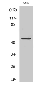 Vimentin Polyclonal Antibody