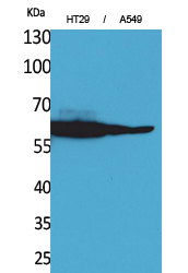 Catalase Polyclonal Antibody