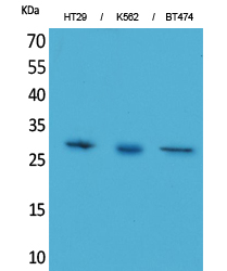 BRMS-1 Polyclonal Antibody