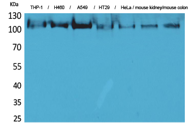 cPLA2 Polyclonal Antibody