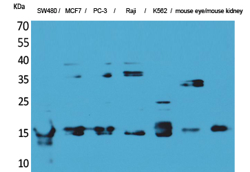 MK Polyclonal Antibody