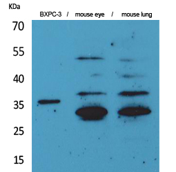 TF Polyclonal Antibody