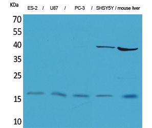 IL-1β Polyclonal Antibody