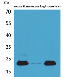 ADM Polyclonal Antibody