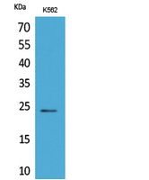 CyPB Polyclonal Antibody