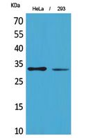 SDHB Polyclonal Antibody