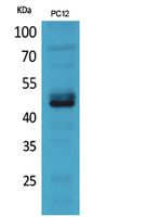 NKp44 Polyclonal Antibody