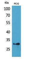 HLA-DQB1/2 Polyclonal Antibody