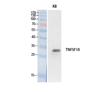 TRAIL Polyclonal Antibody