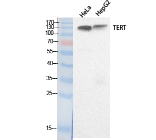 TERT Polyclonal Antibody