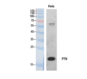 PTN Polyclonal Antibody