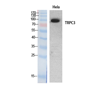 TRPC3 Polyclonal Antibody