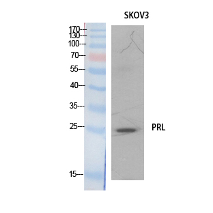 Prolactin Polyclonal Antibody