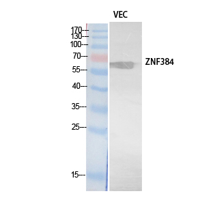 ZNF384 Polyclonal Antibody