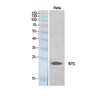 Neurotensin Polyclonal Antibody