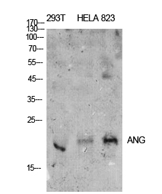 ANG I Polyclonal Antibody