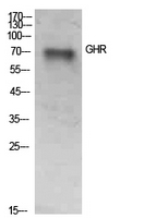 GHR Polyclonal Antibody