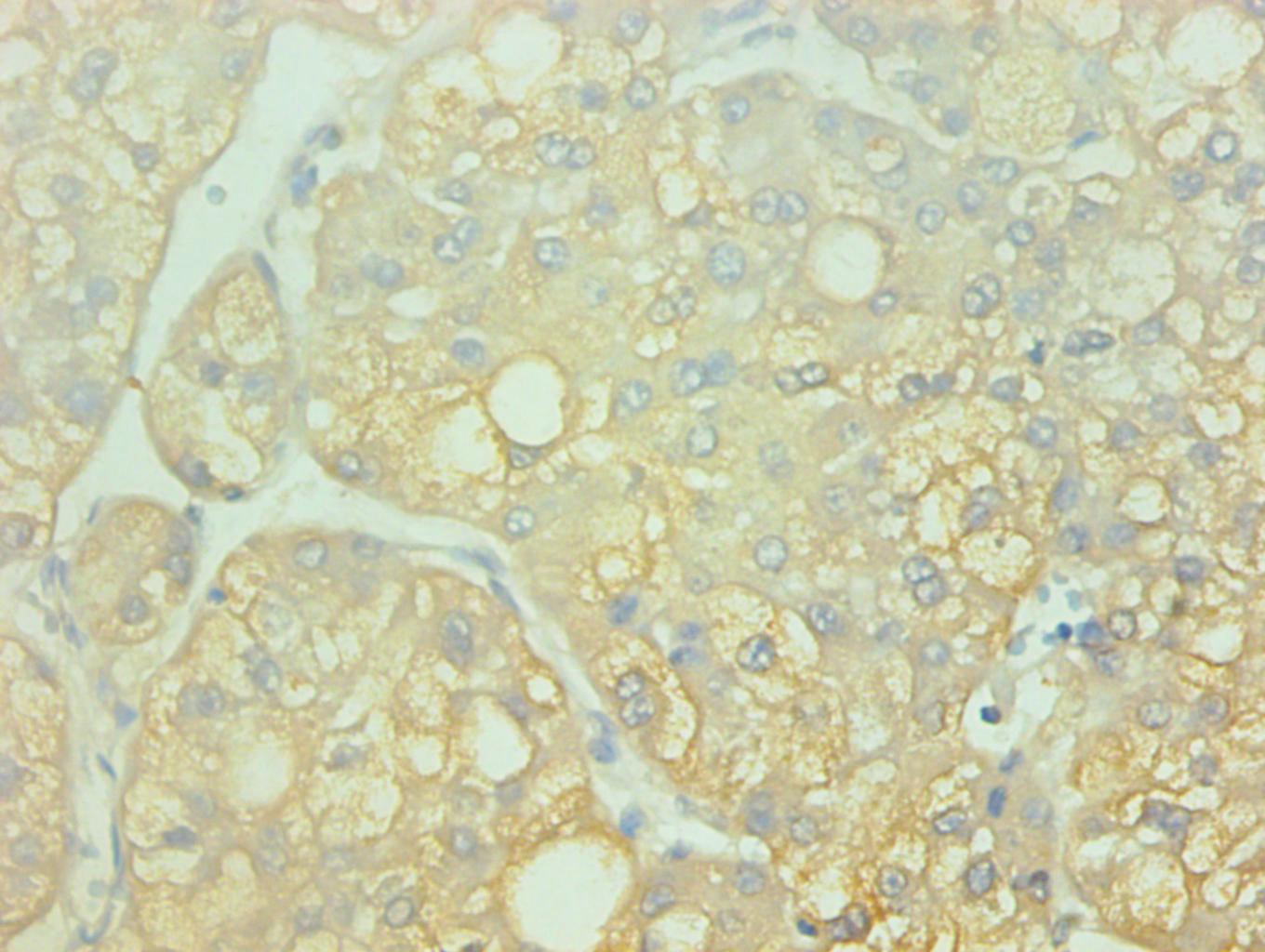 AHSG Monoclonal Antibody