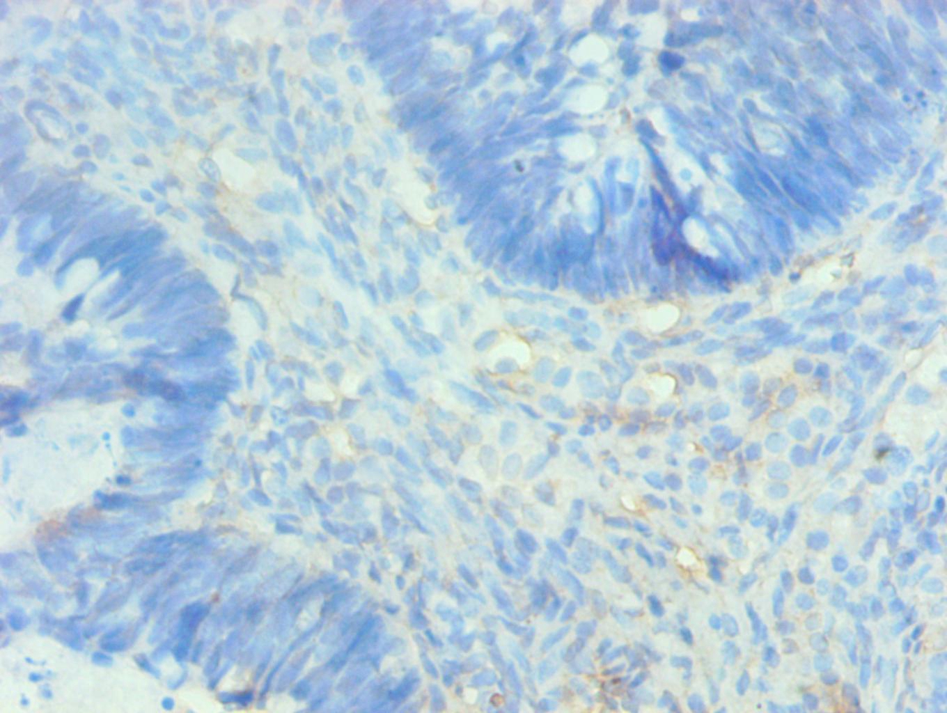 AHSG Monoclonal Antibody