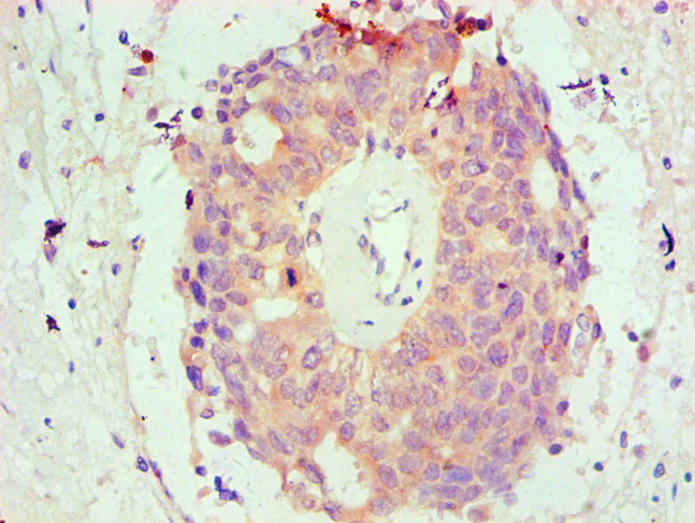 Bcl-2-like protein 1 Monoclonal Antibody