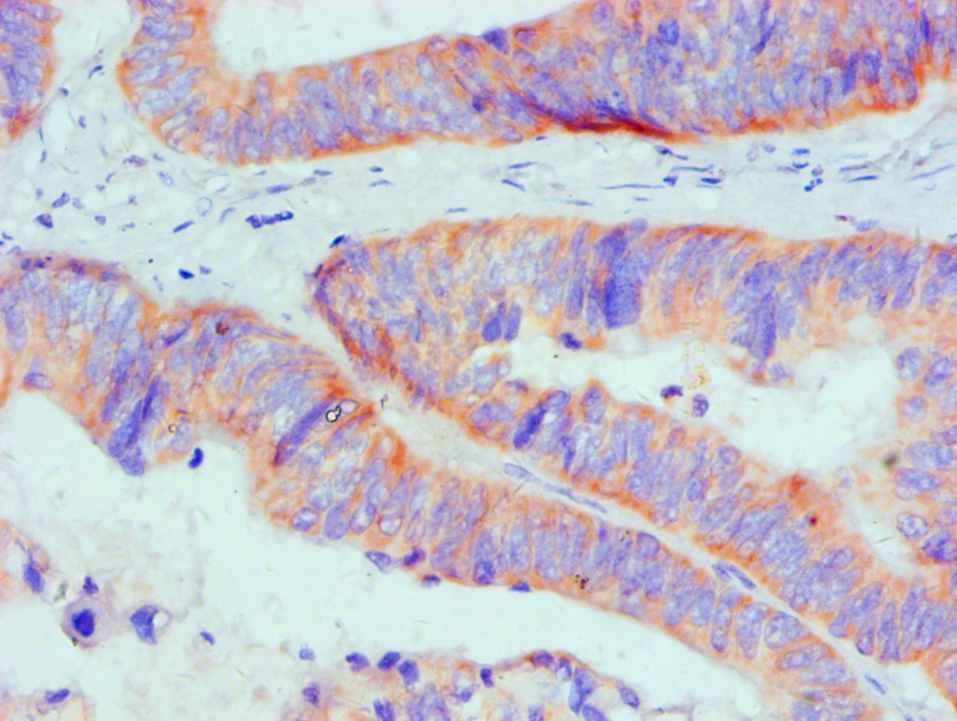 Bcl-2-like protein 1 Monoclonal Antibody