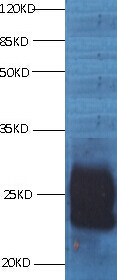 CD59 Monoclonal Antibody