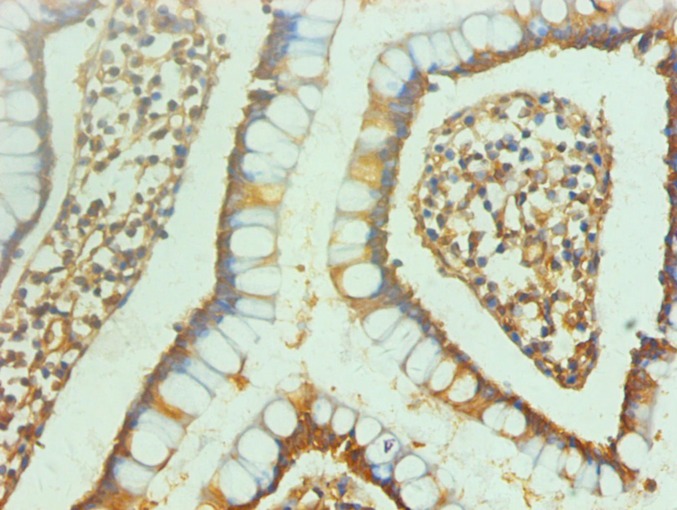 ENO2/NSE Monoclonal Antibody