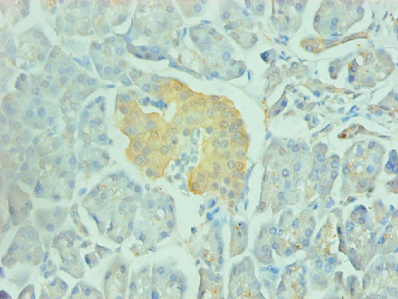 ENO2/NSE Monoclonal Antibody