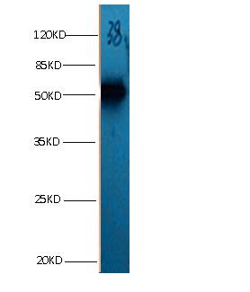 ANXA2 Monoclonal Antibody