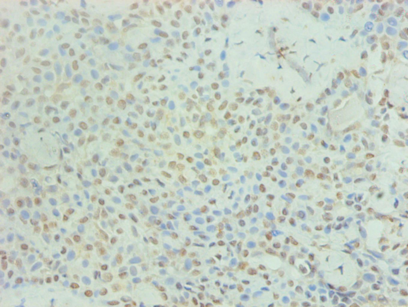 PRL Monoclonal Antibody