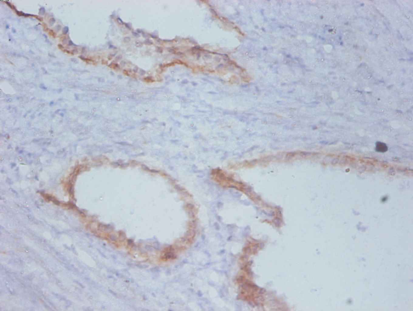 Timp1 Monoclonal Antibody