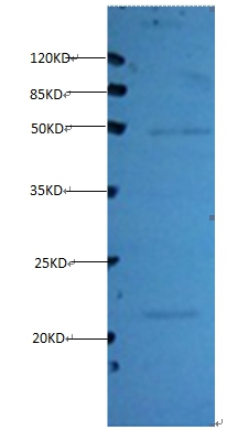 Timp1 Monoclonal Antibody