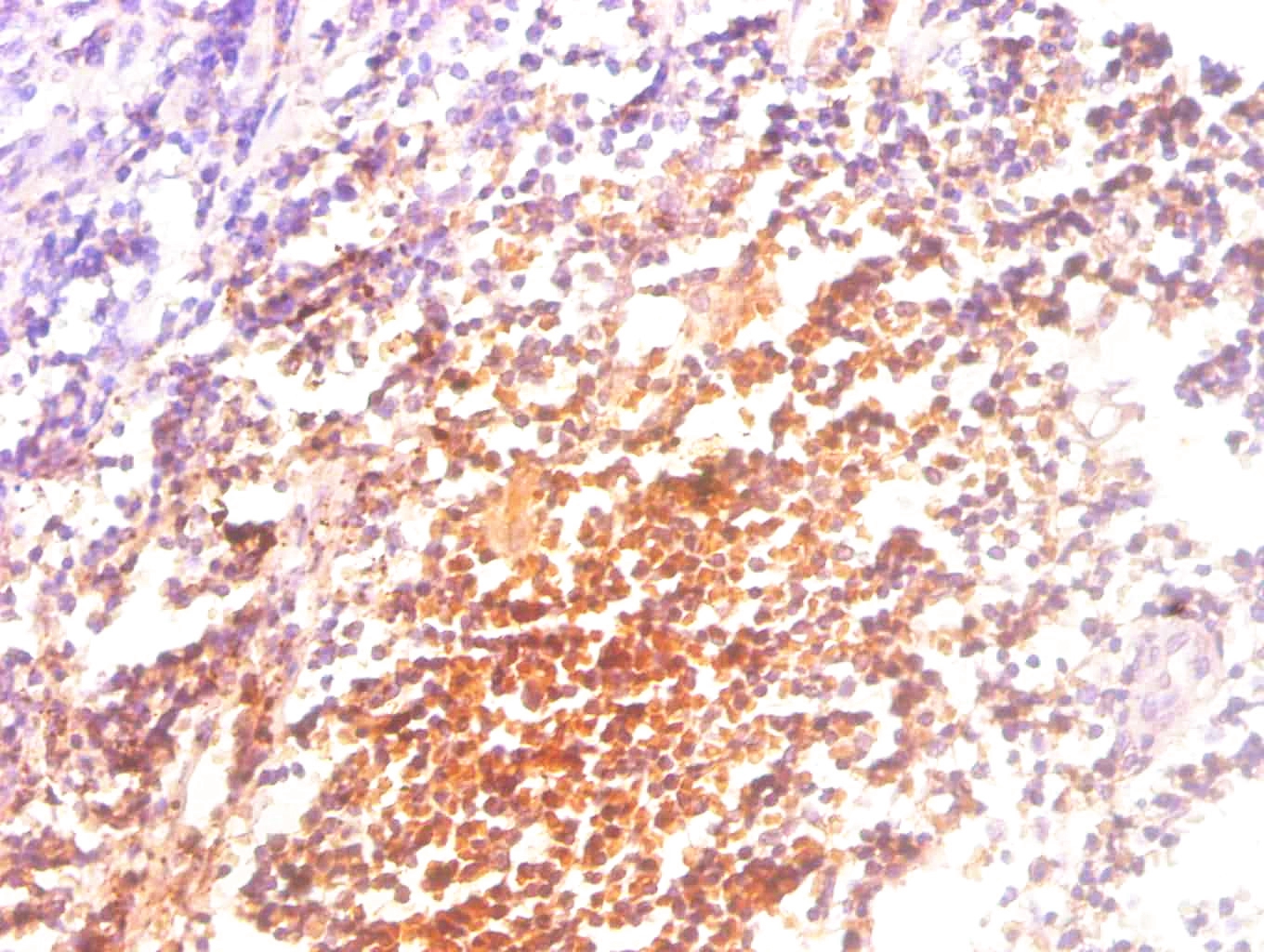 Beta-2-microglobulin Monoclonal Antibody