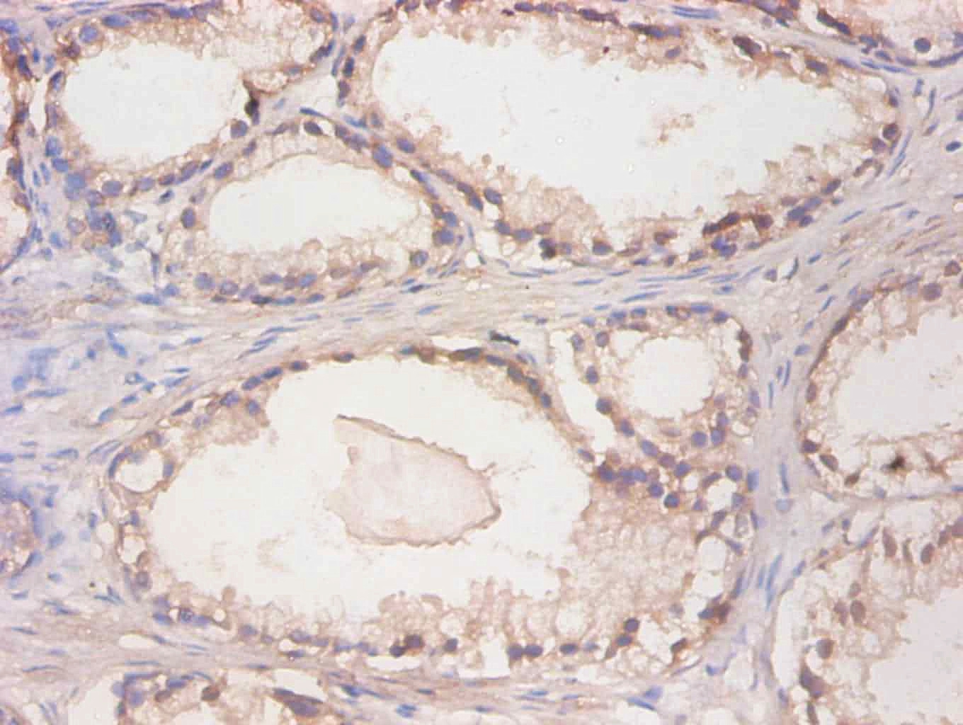 Cystatin C Monoclonal Antibody