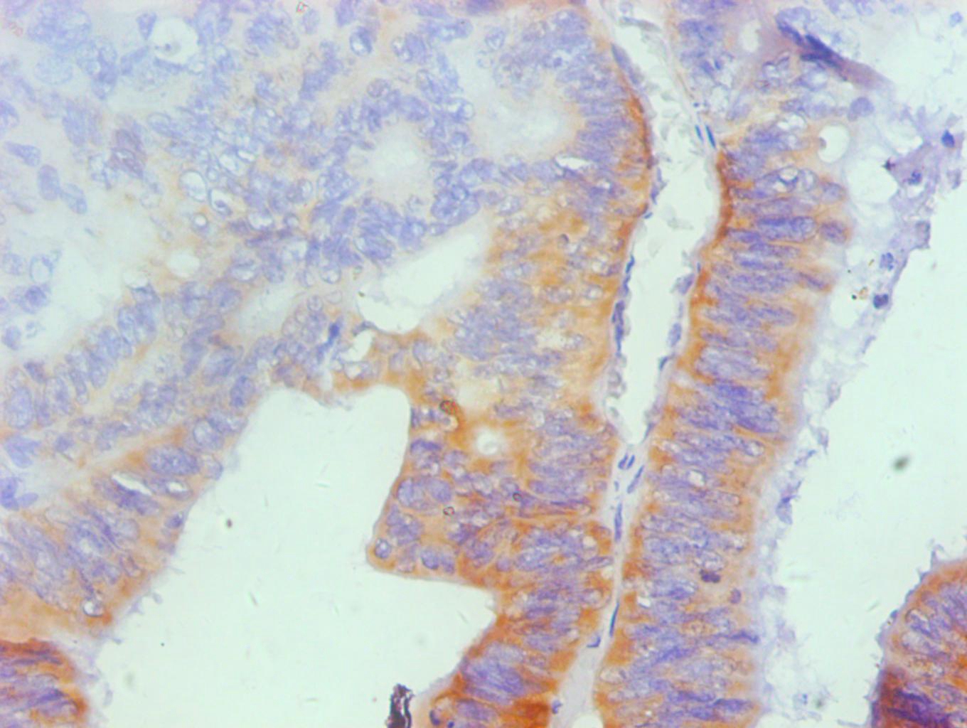 Osteopontin Monoclonal Antibody