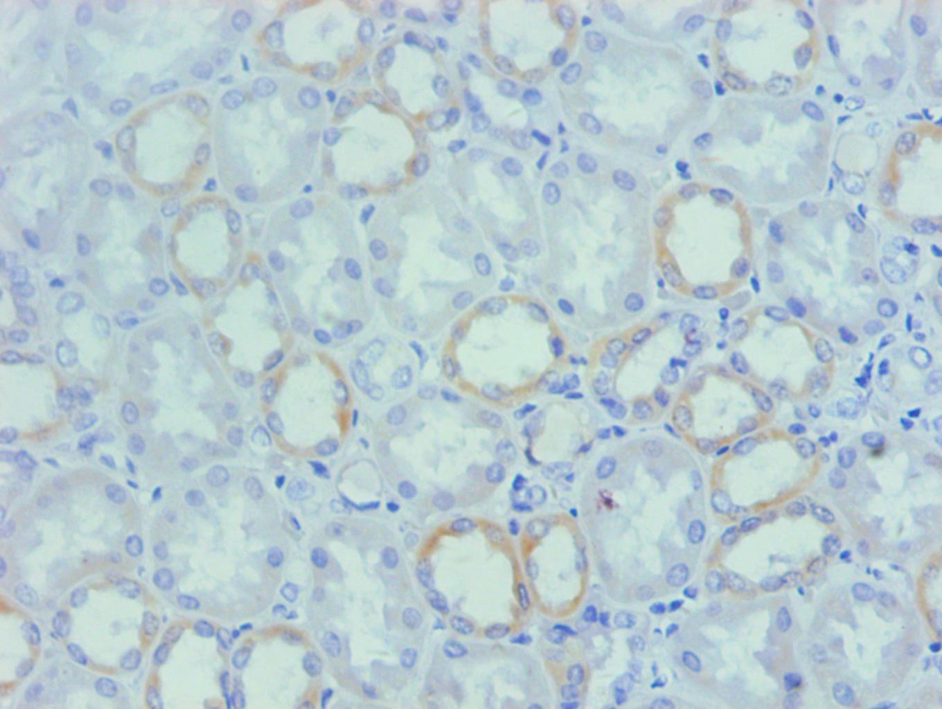 Osteopontin Monoclonal Antibody