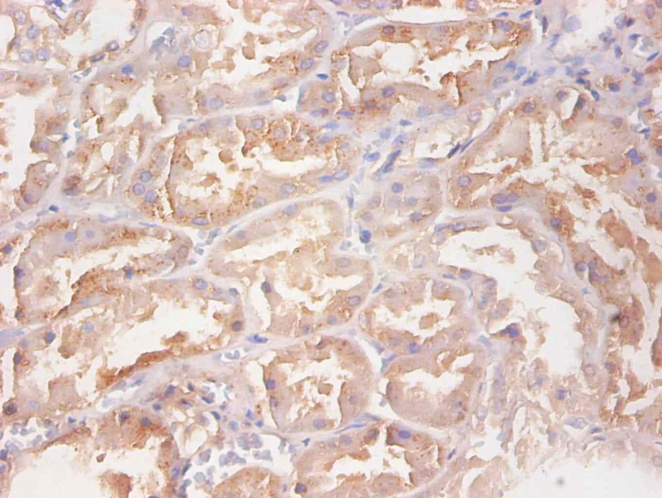 RBP4 Monoclonal Antibody