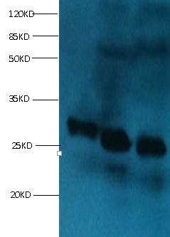 RBP4 Monoclonal Antibody