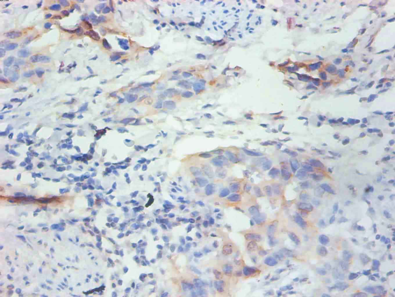 FABP3 Monoclonal Antibody