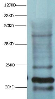 Myoglobin Monoclonal Antibody