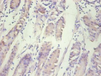 IL8 Monoclonal Antibody