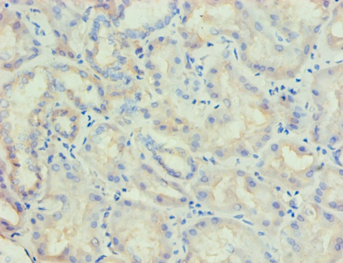 LP-PLA2 Monoclonal Antibody