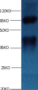 LP-PLA2 Monoclonal Antibody