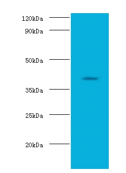 Alcohol dehydrogenase 1B polyclona Antibody