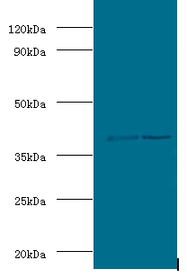 Alcohol dehydrogenase class-3 Polyclonal Antibody