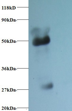 α1-acidglycoprotein Polyclonal Antibody