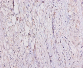 Complement C1q tumor necrosis factor-related protein 3 Polyclonal Antibody