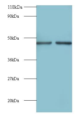 Eukaryotic initiation factor 4A-II Polyclonal Antibody